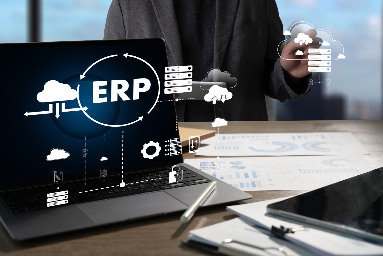 تحديث وترحيل ERP